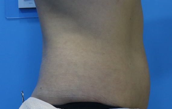 2번 After