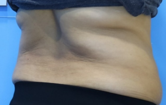4번 Before