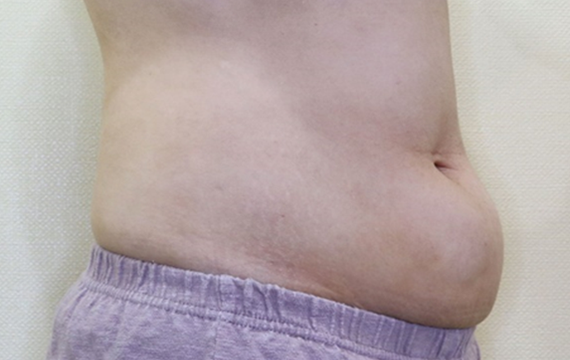 3번 Before